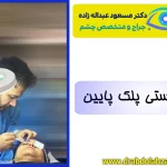 بلفاروپلاستی پلک پایین | بهترین جراح