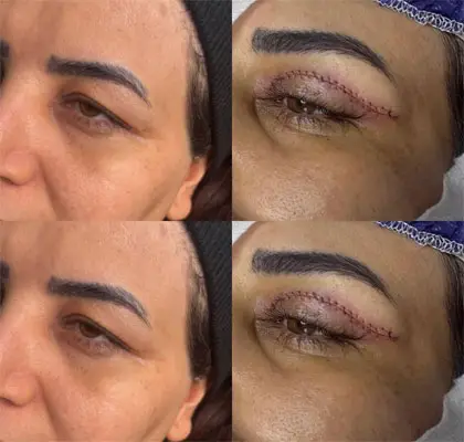 عمل بلفاور