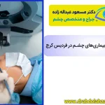 فمتولیزیک چشم | نحوه انجام عمل، مزایا و معایب، مراقبتها و هزینه