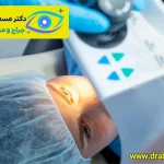 عمل آب مروارید چشم (جراحی کاتاراکت)